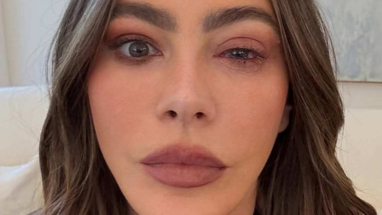 Sofía Vergara sufrió una reacción alérgica en sus ojos