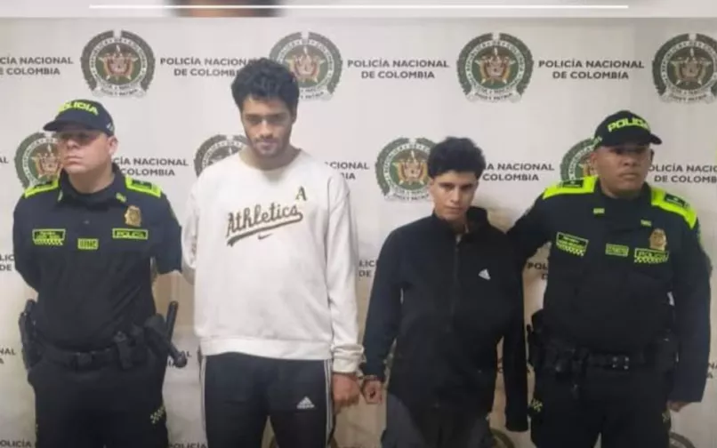 alias mandibula y aretes