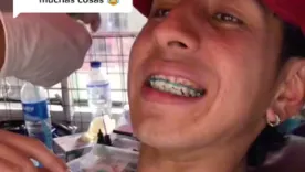 Apareció otro sitio donde ponen Brackets a $100.000 en Bogotá