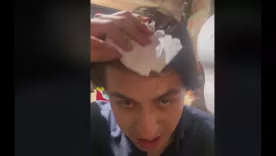 Cabeza rota