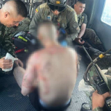 Soldado quemado 